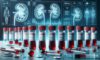 Kidney Blood Test in Blackburn: The Essential Guide