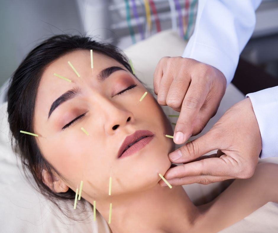 Cosmetic Acupuncture: Important Drawbacks to Note