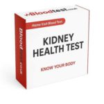 Kidney Blood Test in Newark-on-Trent: Your Local Guide